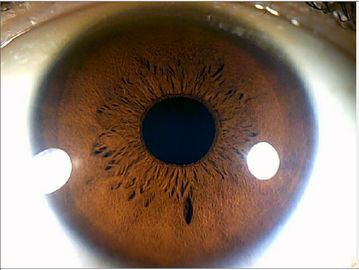 Analyseur médical d'iris d'oeil d'appareil photo numérique de Megapixel de portée d'iris de 12.0MP USB