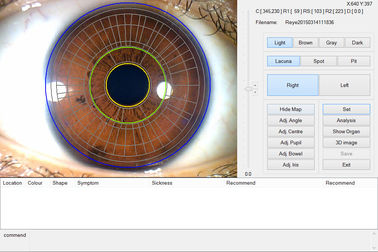 L'analyseur tenu dans la main de scanner d'iris d'oeil de la CE portative pour la santé détectent