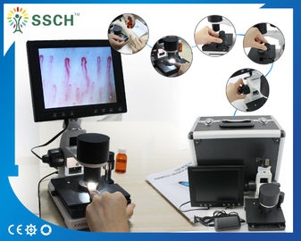 Capillaire visuel portatif de repli du derme de microscope de microcirculation avec du CE