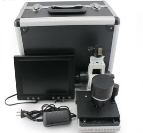 essai capillaire de repli du derme de microscope de la microcirculation 600cd/m2 relié à l'ordinateur portable