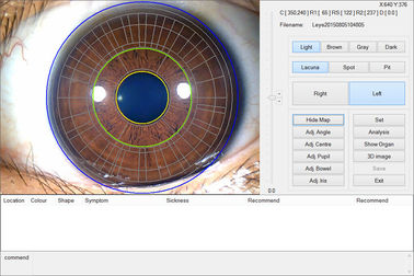 approbation de la machine d'essai d'oeil de caméra de 12.0MP Digital Iriscope Iridology CE/DHL