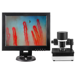 Sortie capillaire du rapport optique DC12V 2A du microscope 600X de microcirculation de sang