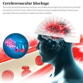 Thérapie blanche de lésion cérébrale de Photobiomodulation de machine d'analyseur de santé de couleur