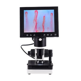Rapport optique mené portatif du microscope 400x de Capillaroscopy de pli de clou d'affichage
