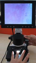 Colorez les pixels capillaires du microscope 380000 d'équipement de microcirculation de repli du derme avec du CE