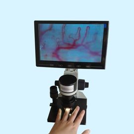Microscope de microcirculation de repli du derme pour le nutritionniste, microscope de clou