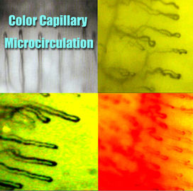 Microscopie capillaire de repli du derme d'hôpital/fonction multi microscope de microcirculation pour médical