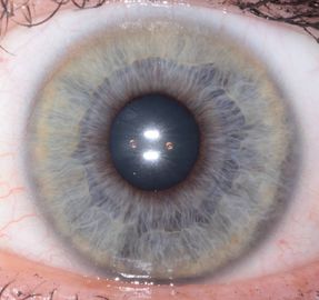 L'analyseur tenu dans la main de scanner d'iris d'oeil de la CE portative pour la santé détectent