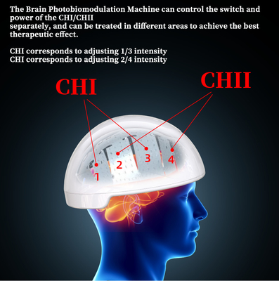 Thérapie Brain Helmet Transcranial Magnetic Stimulator Photobiomodulation de Rtms
