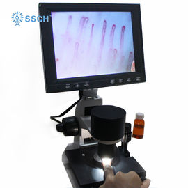 Rapport optique médical de microscope de microcirculation capillaire avec 380 fois