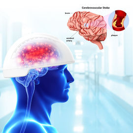 stimulation magnétique Transcranial de cerveau de machine de thérapie de Neurofeedback de machine de thérapie de la lumière 810nm