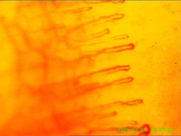 Microscope capillaire de sang pour détecter la santé de corps, garantie de 1 an