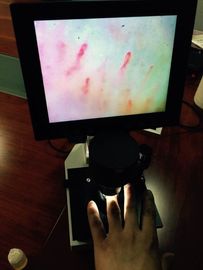 Microscope approuvé de microcirculation de couleur d'écran d'affichage à cristaux liquides d'OEM de la CE pour la vérification de clou